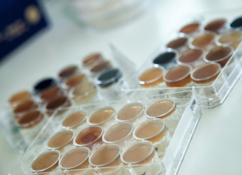 bacterial culture on plates
